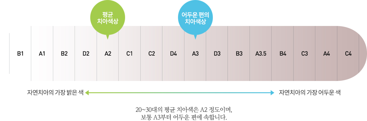 치아색상의단계